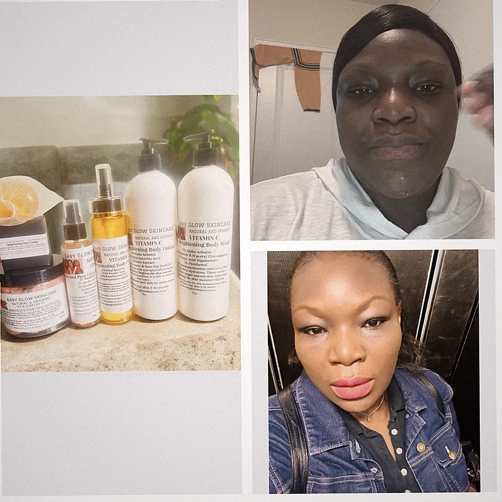 Brightening Face and Body Set- Hyperpigmentation Skin Dark Spots